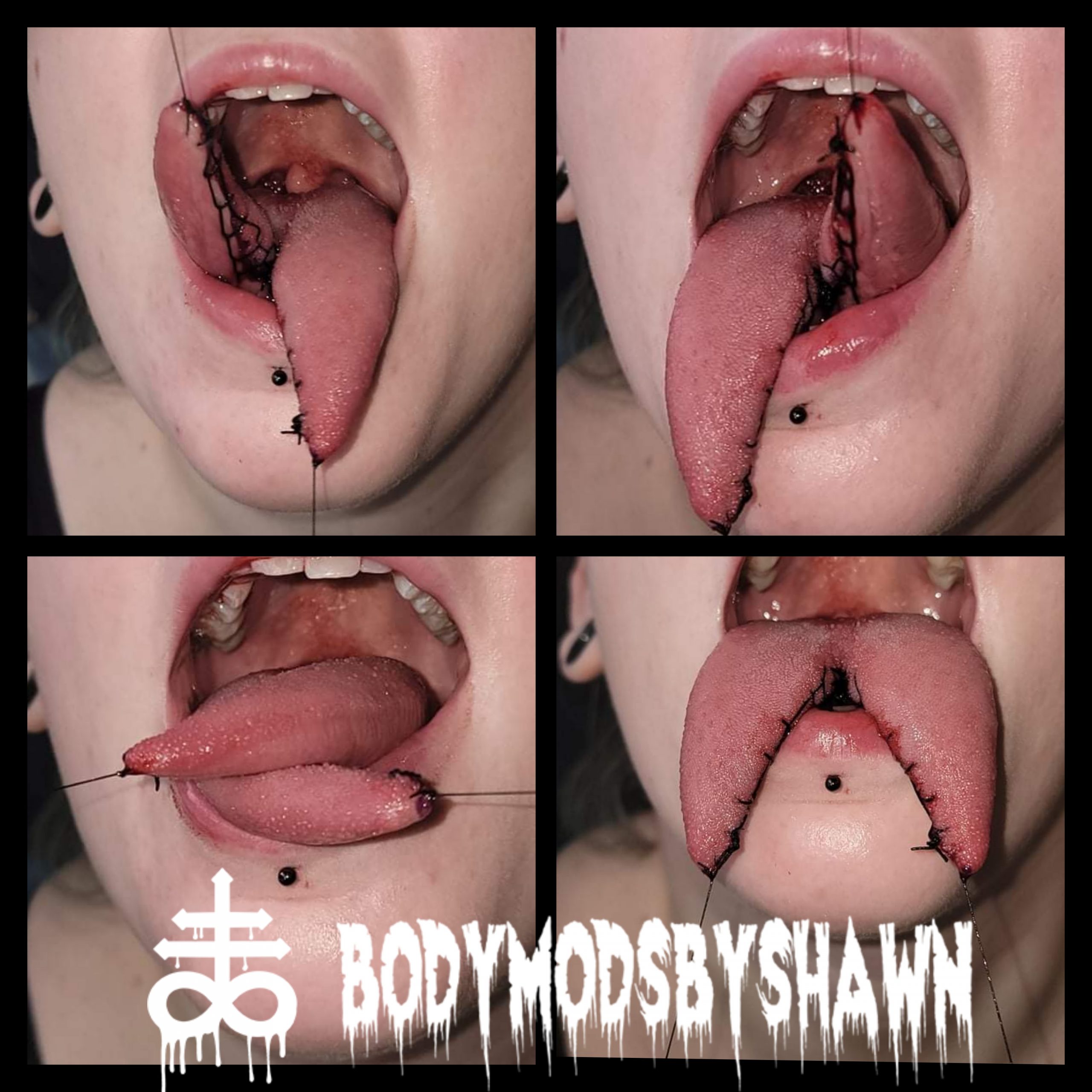 Tongue Splits Body Mods By Shawn